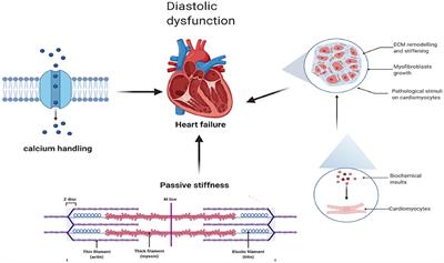 Similarities and Differences Between HFmrEF and HFpEF